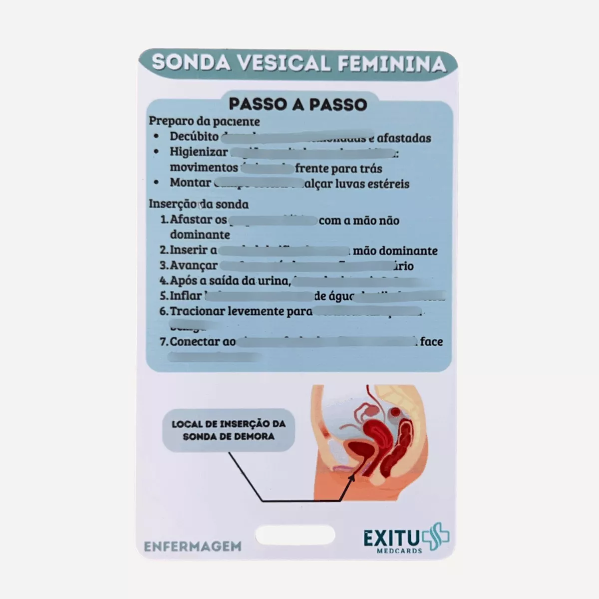 Sonda vesical feminina (Enfermagem) - Imagem 2